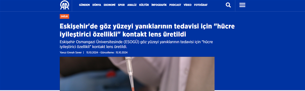 ESOGÜ'de göz yüzeyi yanıklarının tedavisi için rejeneratif kontakt lens geliştirildi